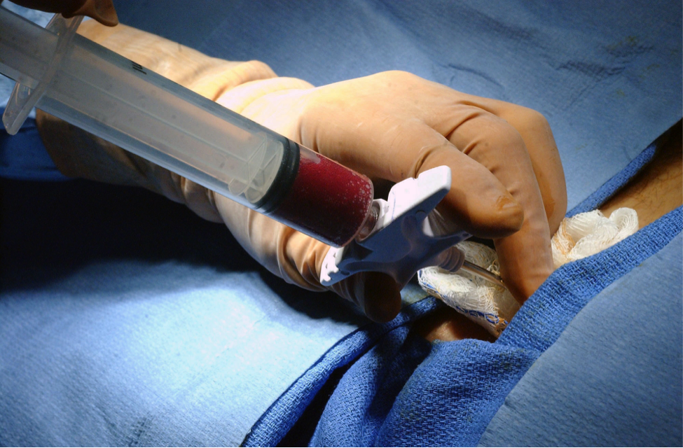 New way to transplant blood stem cells without toxic chemo | Image: wikimedia.com